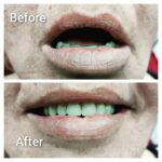 beforeafter2
