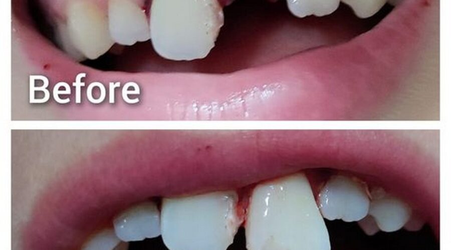 beforeafter1